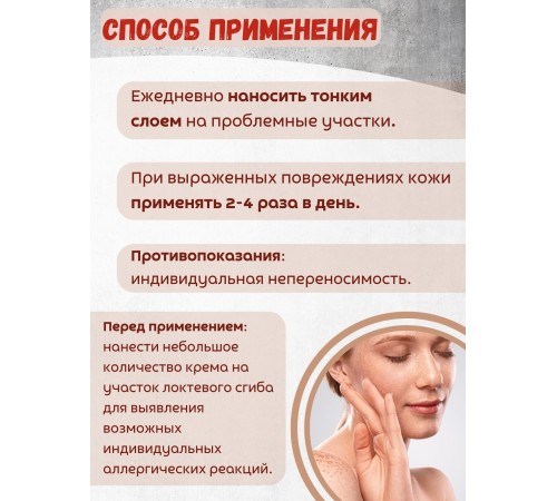 Крем от купероза Куперозан-Fito Фитол-9, 75 г
